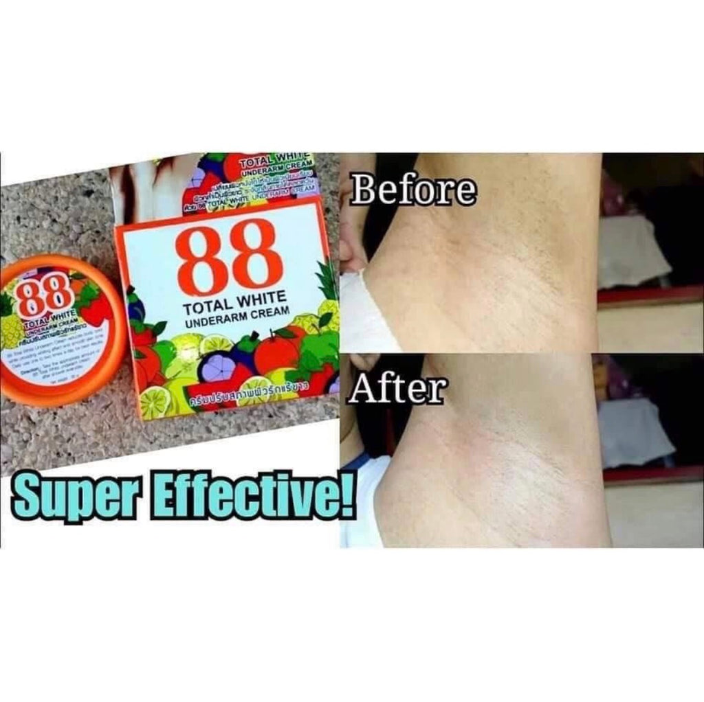 88 TOTAL WHITE UNDERARM CREAM 35G