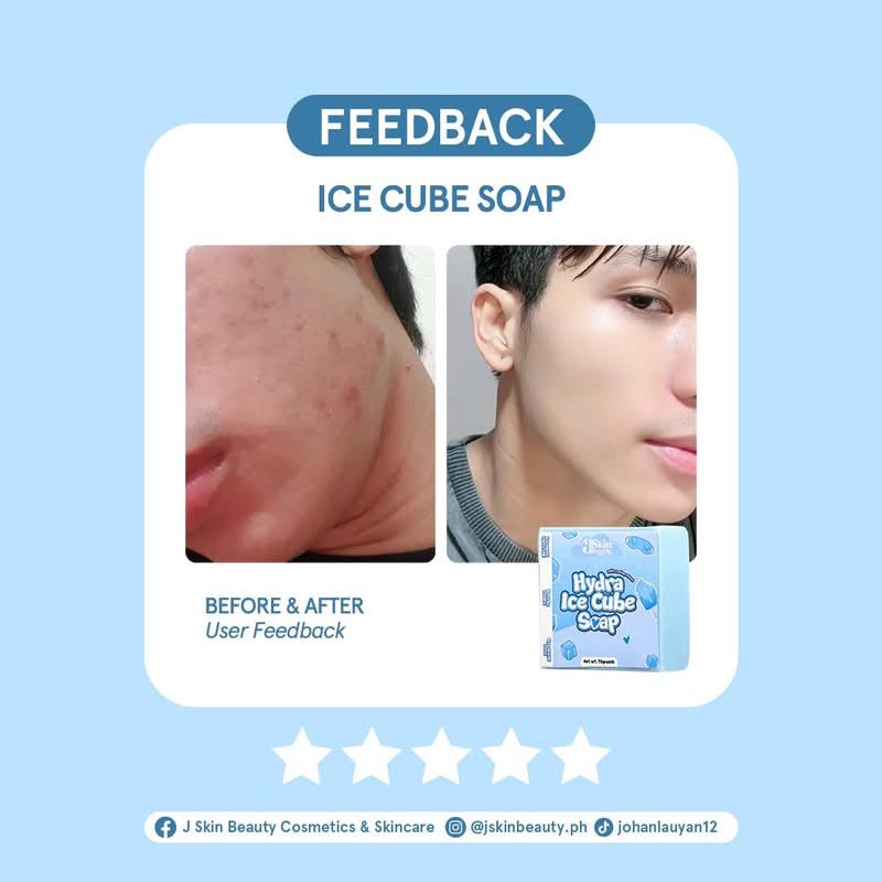 JSKIN HYDRA ICE CUBE SOAP 70G