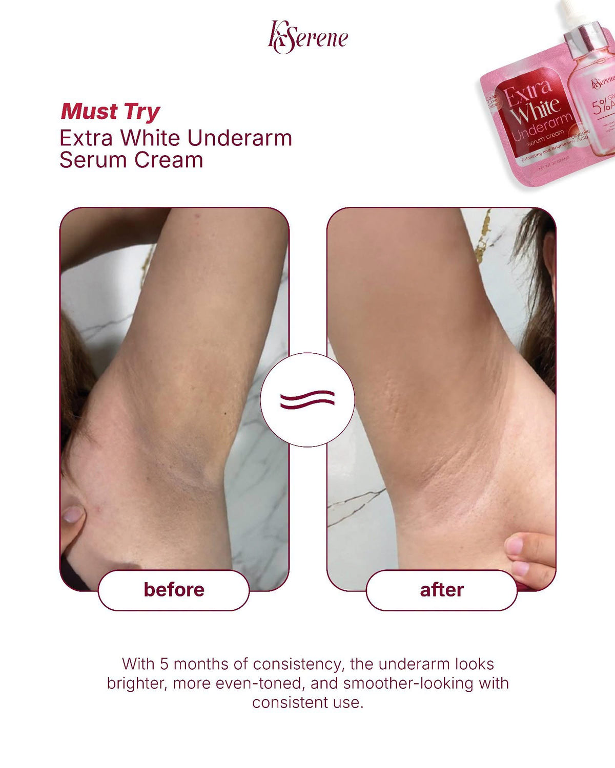 KSERENE 4-IN-1 UNDERARM DEO SPRAY – 60ML