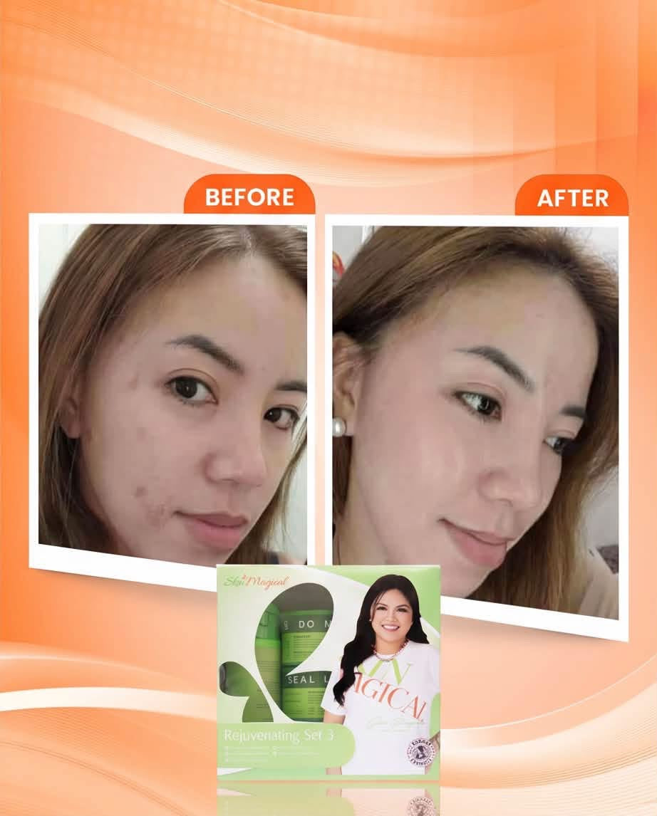 SKIN MAGICAL REJUVENATING SET 3
