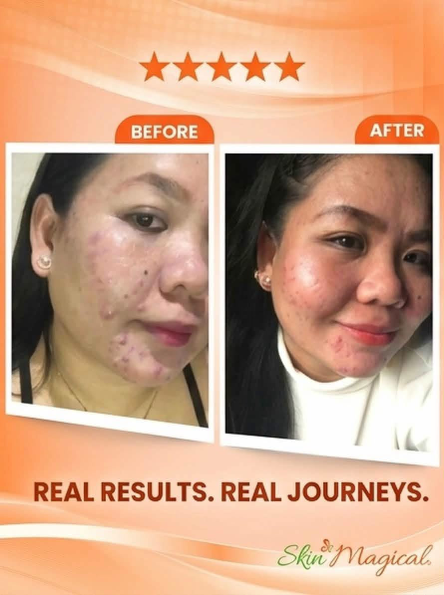 SKIN MAGICAL REJUVENATING SET 3