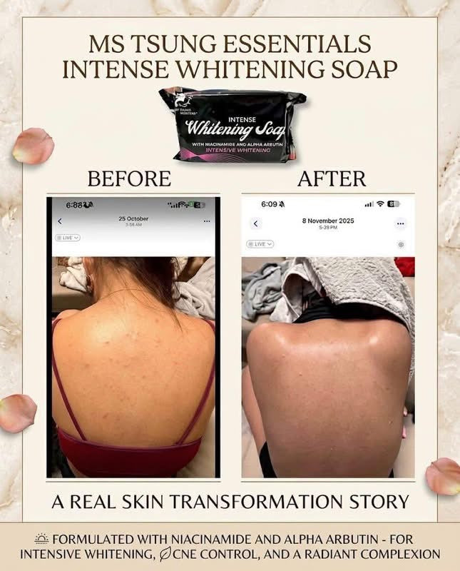MS. TSUNG INTENSE WHITENING SOAP 135G