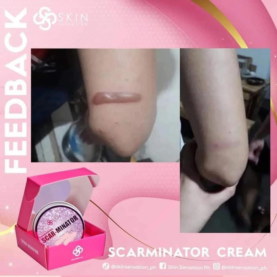 SCARMINATOR CREAM 40g